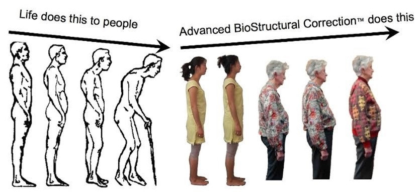 Chiropractor Alternative Birmingham | Pain Relief | Posture Correction